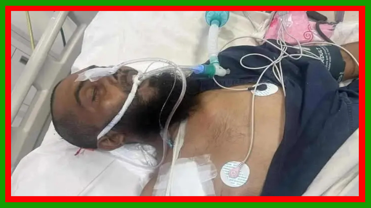 পটুয়াখালীতে সন্ত্রাসী হামলার আহত মফিজুল মৃধা মারা গেছেন