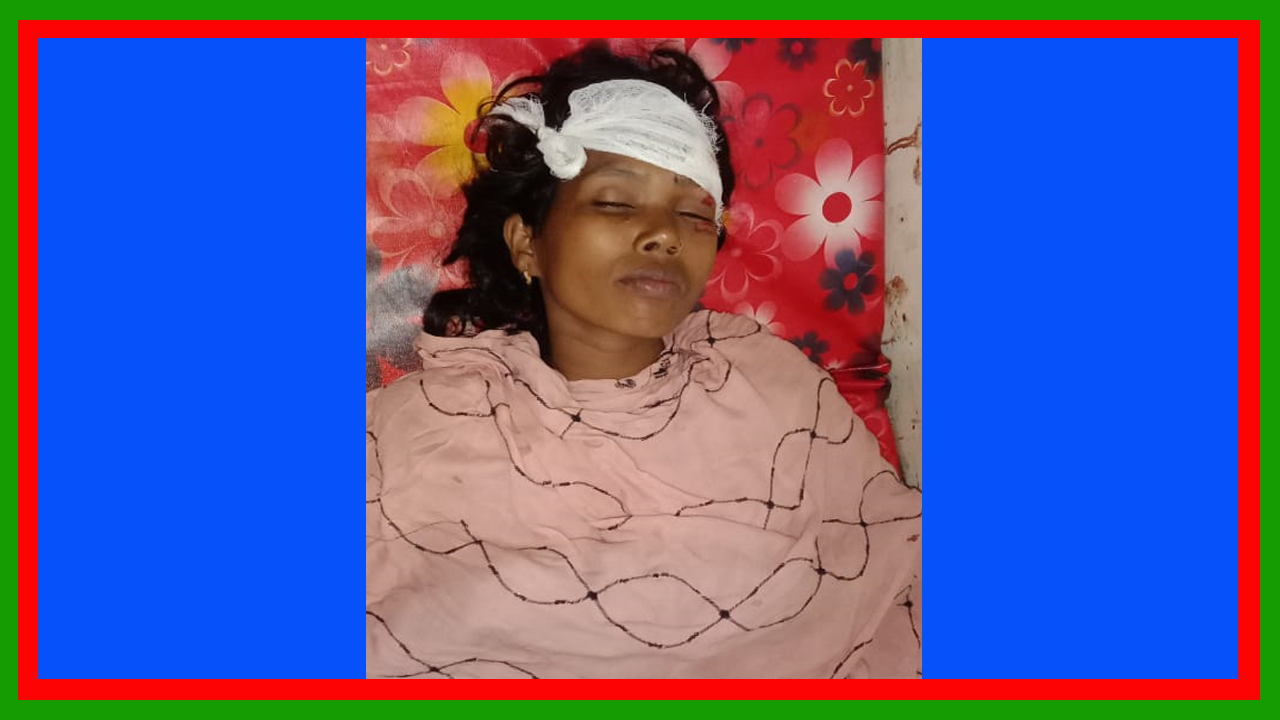 দোয়ারাবাজারে বসতবাড়িতে হামলা ও লুটপাটে আহত রিনা বেগমসহ একাধিক ব্যক্তি