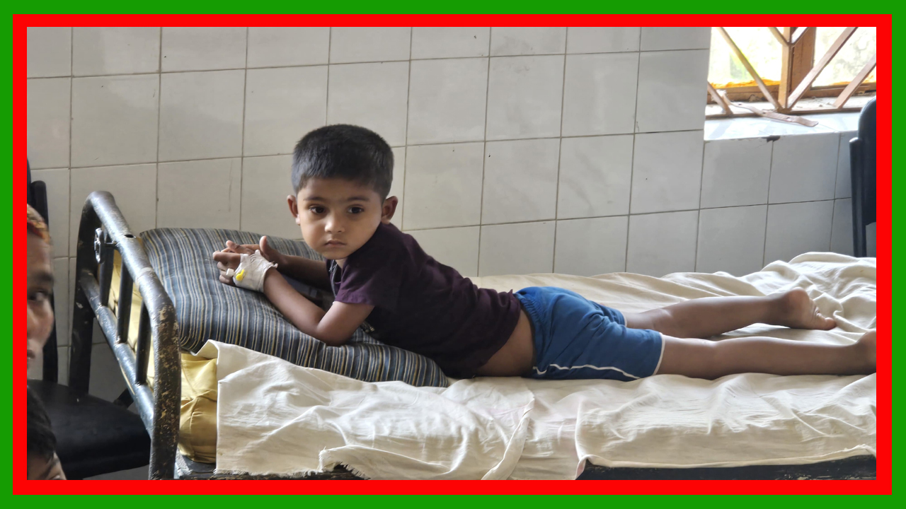 পটুয়াখালীর দুমকিতে হাম উপসর্গে ৬ শিশু হাসপাতালে, এলাকায় আতঙ্ক